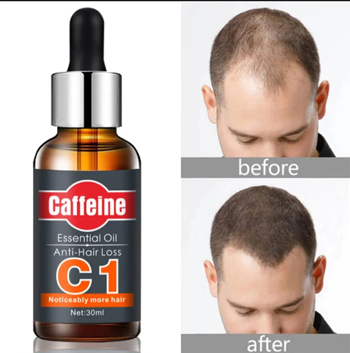 Caffeine - C1 Anti Hair Loss Oil (Original)