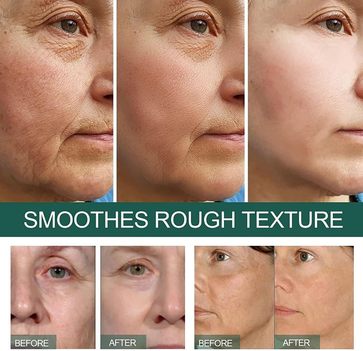 Eelhoe - Dark Spot Correcting Serum