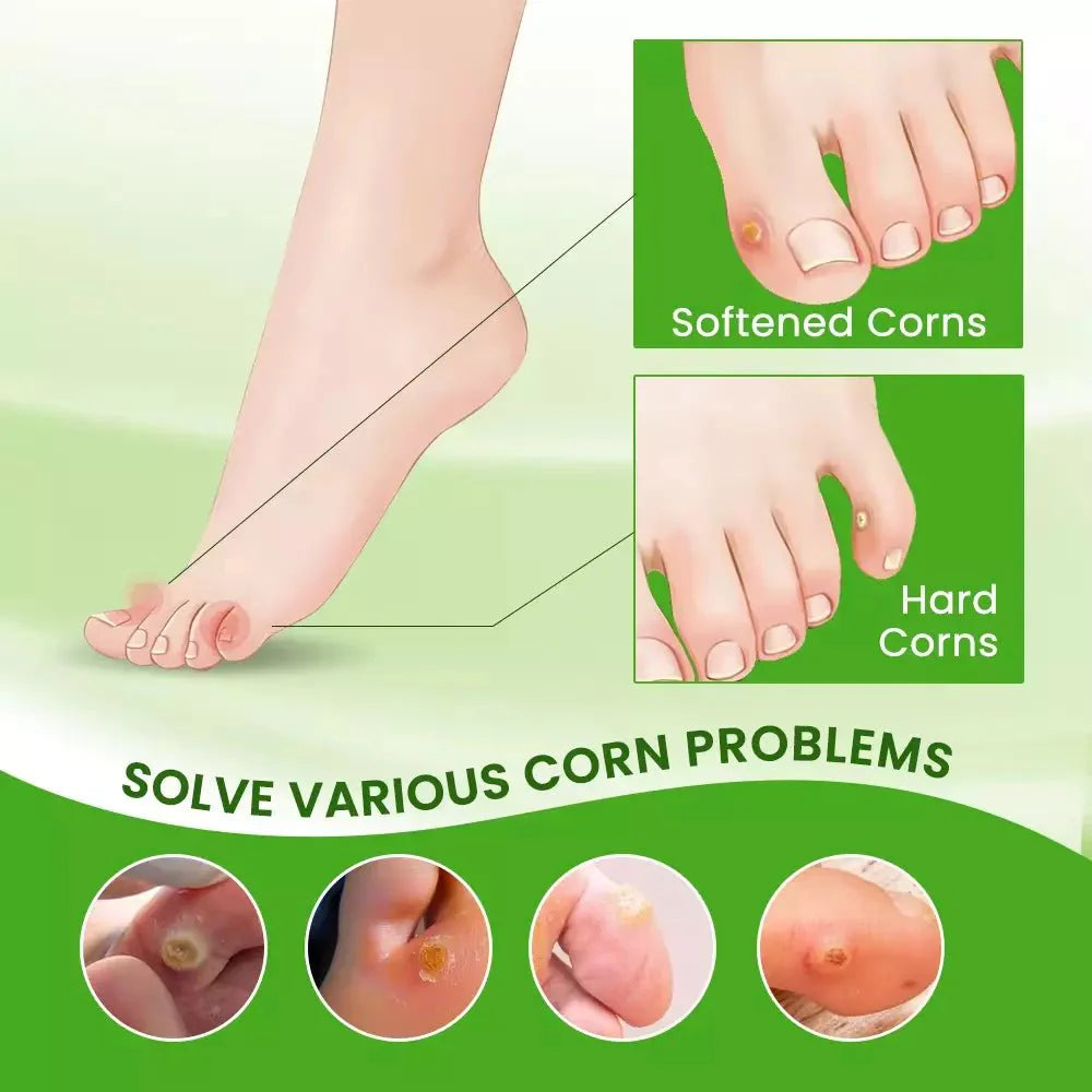 Sumifun - Corns Removal Cream