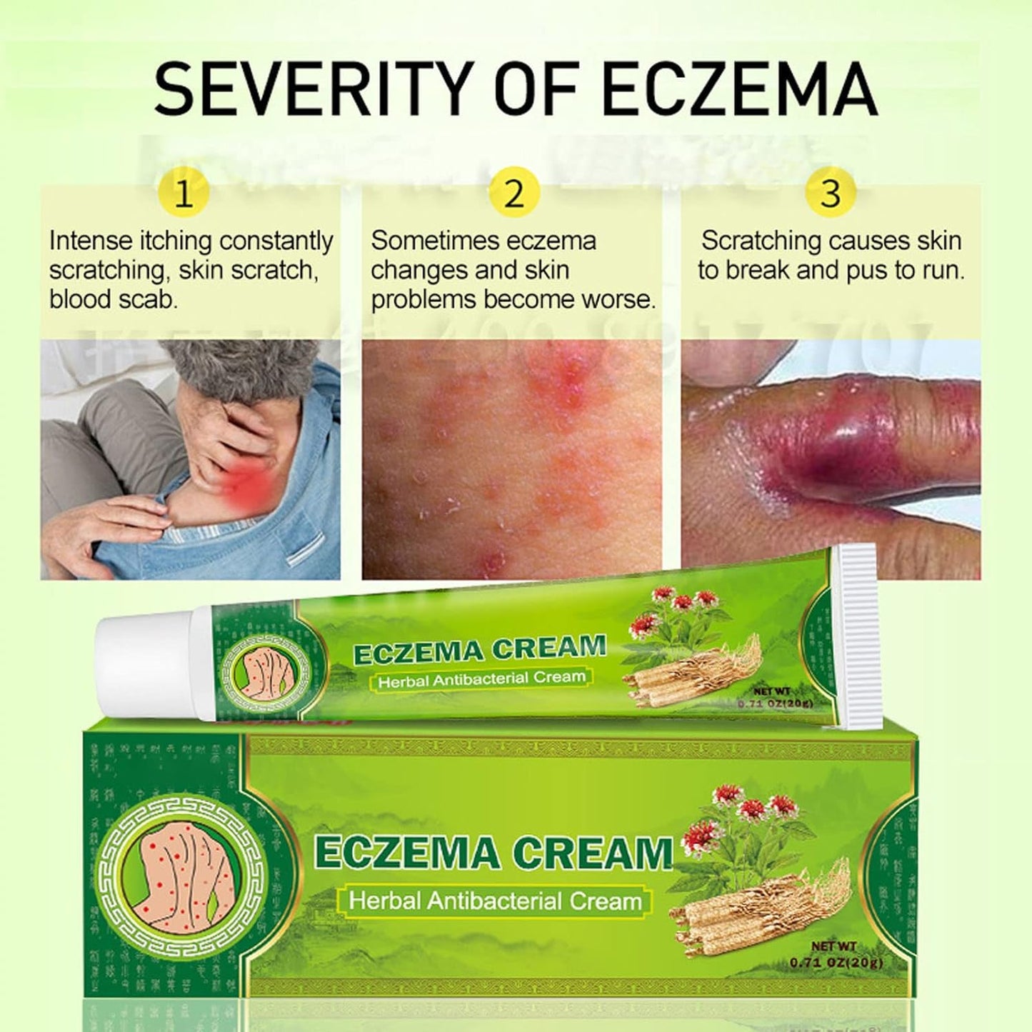 Sumifun - Eczema Skin Cream