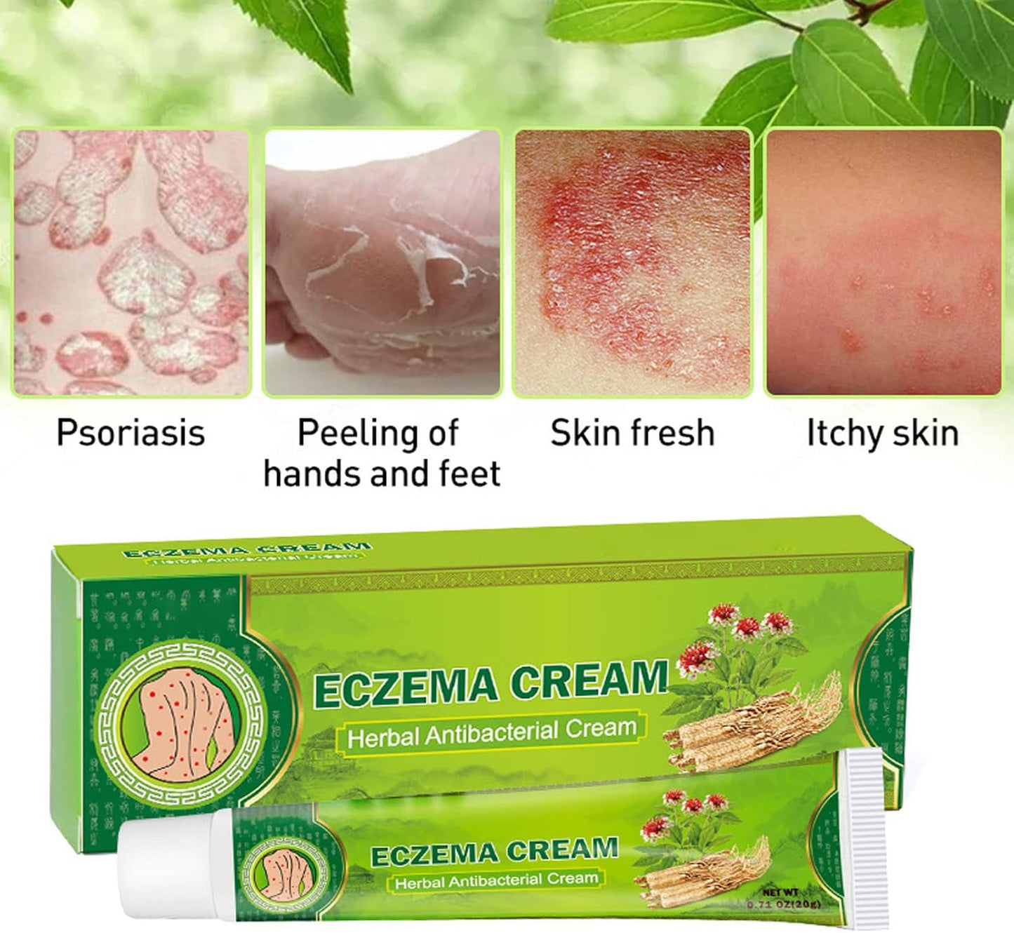 Sumifun - Eczema Skin Cream