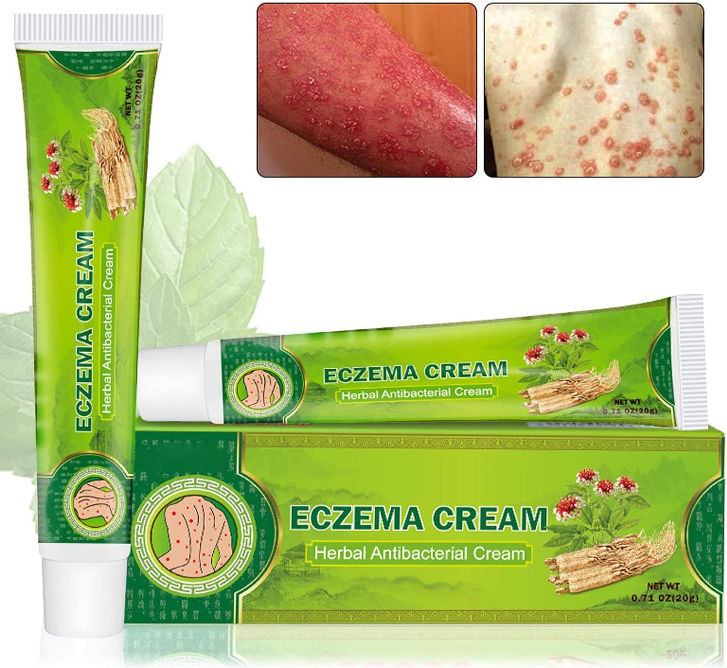 Sumifun - Eczema Skin Cream