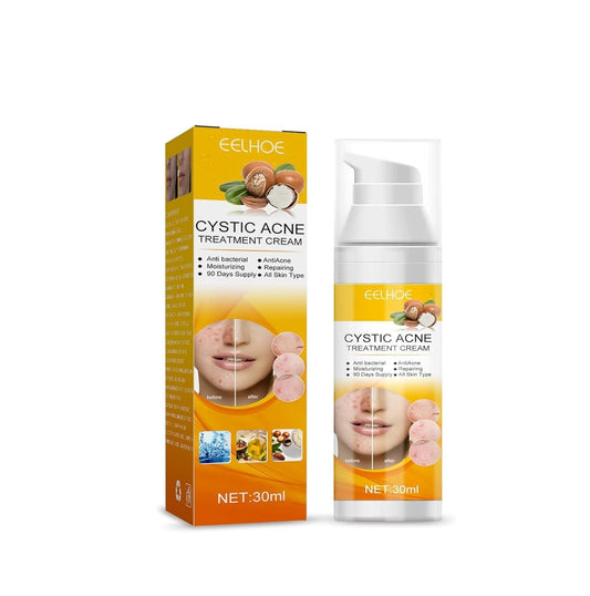 Eelhoe - Cystic Acne Cream (Original)