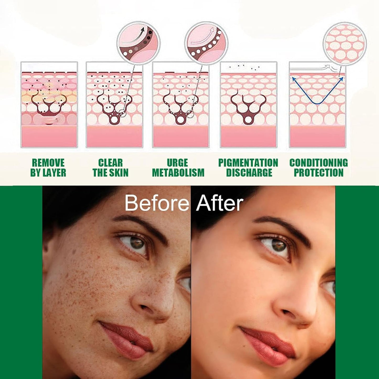 Eelhoe - Dark Spot Correcting Serum