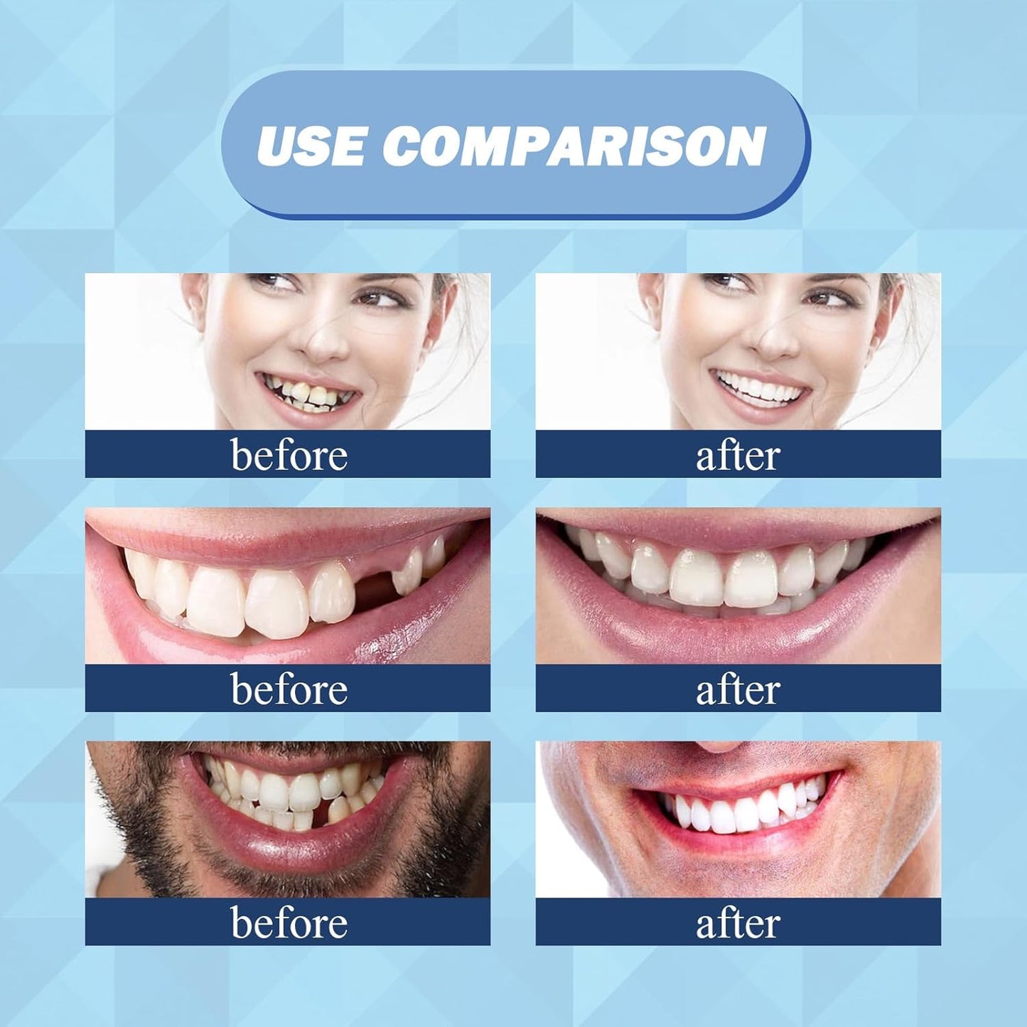 Eelhoe - Thermal Forming False Teeth