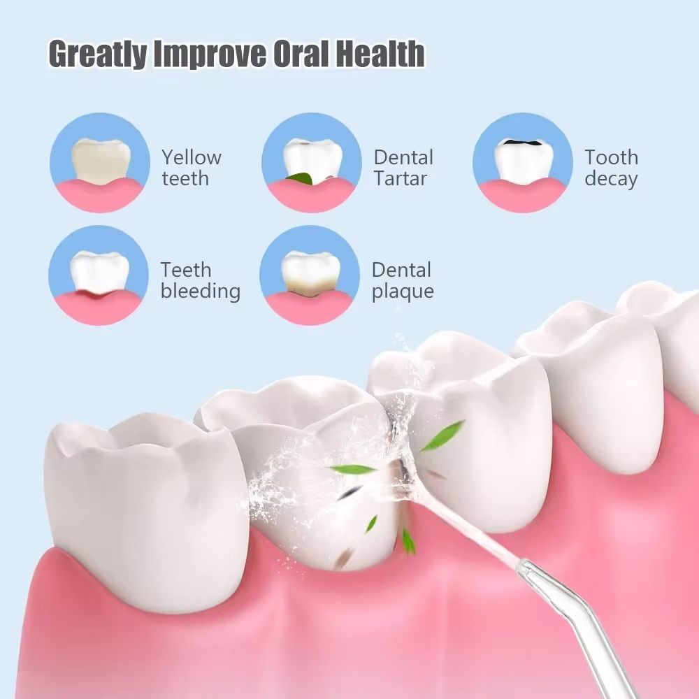 Gold Crest - Oral Irrigator