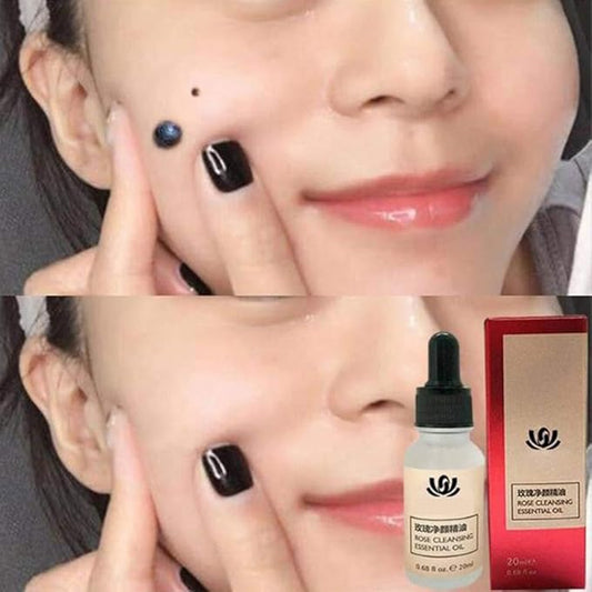 Organic Skin Tag - Essential Oil (Original)