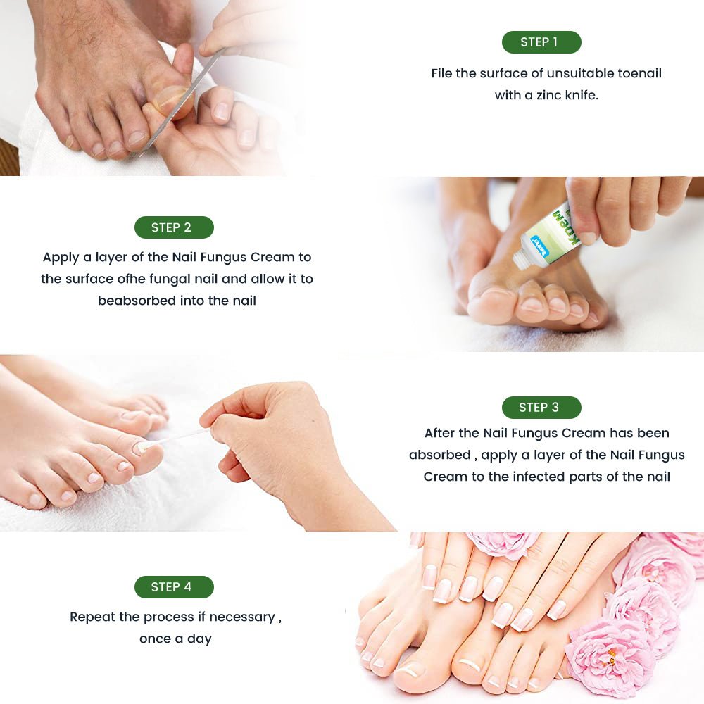 Sumifun - Nail Treatment Repair Gel (Original)